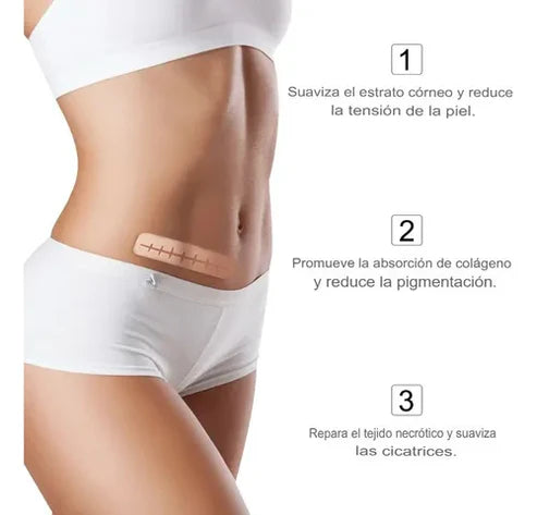 CINTA DE SILICONA PARA ELIMINAR CICATRICES