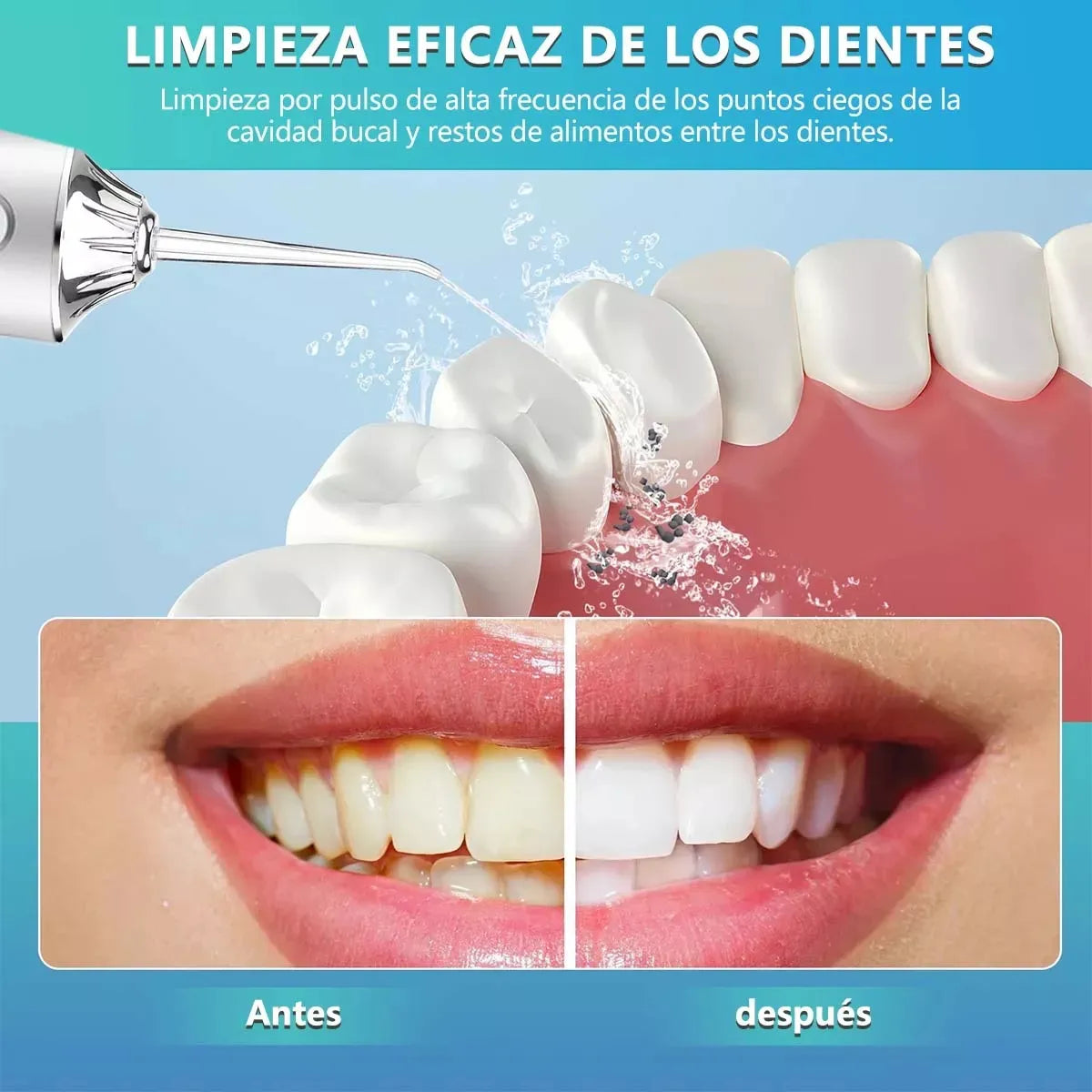 IRRIGADOR BUCAL BLANCO